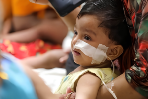 Measles Death Toll Reaches 918 as Hospital Admissions Surge