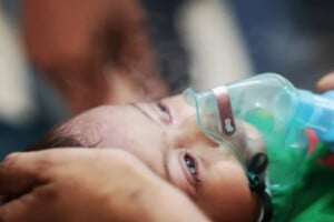 Measles Outbreak Claims 847 Children as Death Toll Quietly Rises
