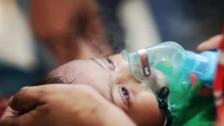 Measles Outbreak Claims 847 Children as Death Toll Quietly Rises