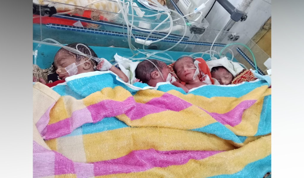 Quadruplets Born in Rajshahi Under Medical Observation