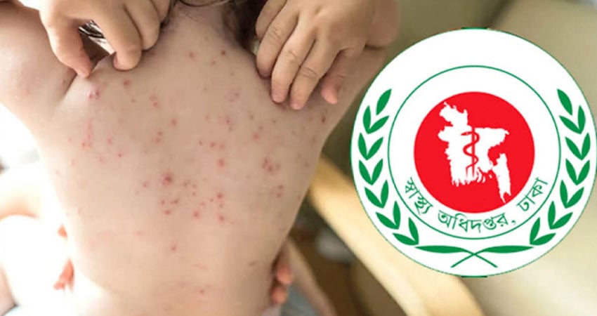 Bangladesh Measles Toll Rises as Three Children Succumb to Symptoms Bangladesh Measles Toll Rises as Three Children Succumb to Symptoms