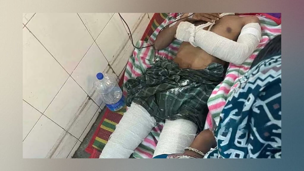 Manikganj Student Leader Seriously Injured in Night Attack 3 Manikganj Student Leader Seriously Injured in Night Attack