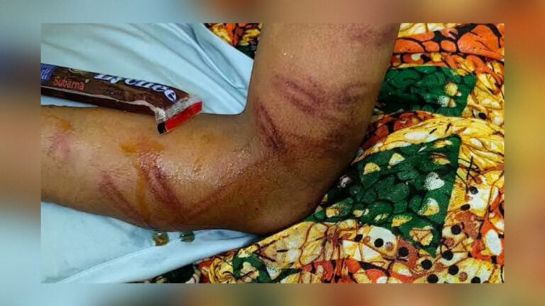 Teacher Held After Alleged Assault on Madrasa Student