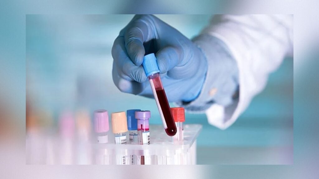 Dhaka Diagnostic Centre Sealed Over Unauthorised Malaysia Medical Tests