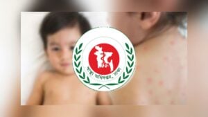 Three More Die with Measles Symptoms as 1,349 Cases Emerge