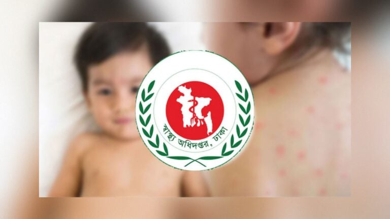 Three More Die with Measles Symptoms as 1,349 Cases Emerge
